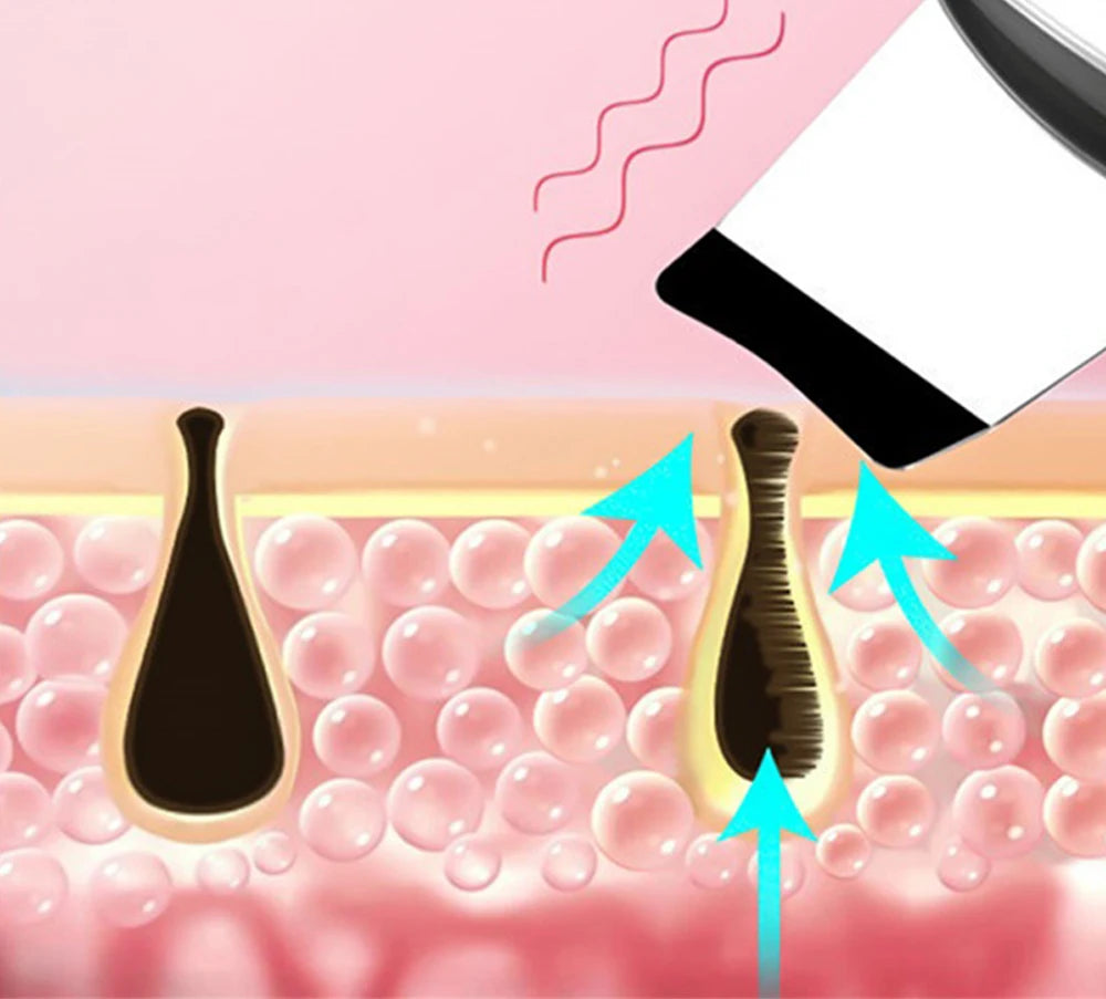 Ultrasonic Skin Scrubber