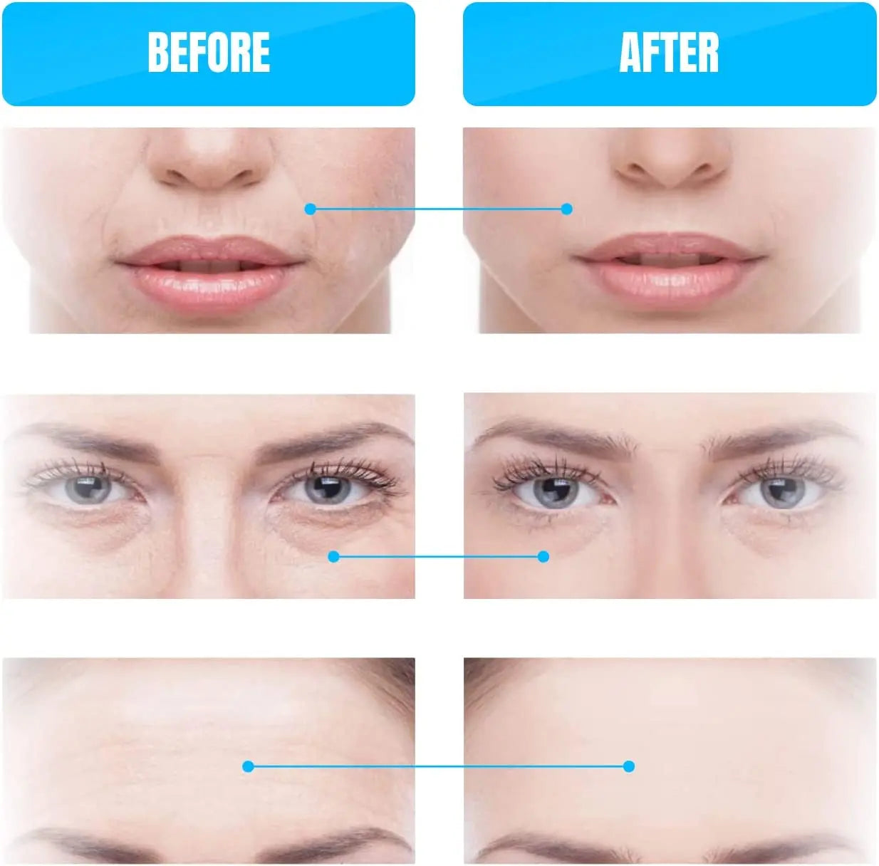 Microcurrent Facial Device