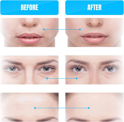 Microcurrent Facial Device